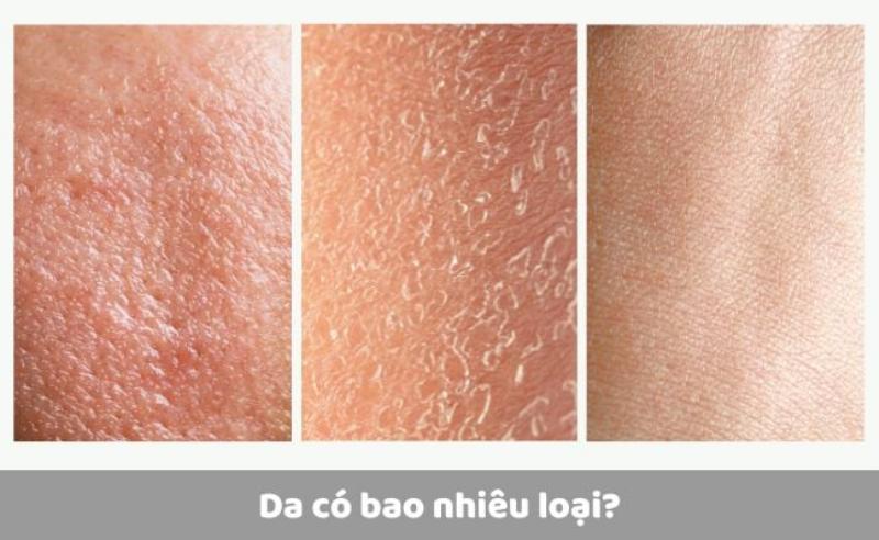 Cách phân biệt các loại hoa tulip trắng khác nhau thông qua ảnh dựa vào đặc điểm cánh hoa